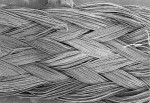 Figure 1b  Braided polyethylene fibers at 25x magnification.
