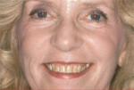 Full facial view showing a defective smile