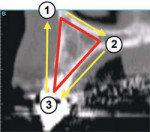 To apply the TOB concept to a cross-sectional slice, a specific triangular pattern can be placed over the image.