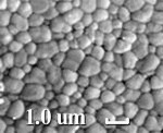 Figure 1  A scanning electron microscope (SEM) (1 μm) shows the density of sintered zirconia.