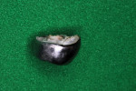 Internal and side views of the extracted tooth demonstrating the crimped margins, which improved the fit.