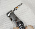 Figure 11  The mini-implant was seated on the rotary implant carrier on the handpiece.