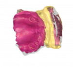 Fig 9. The STL file of the mouth scan body, upper arch. The technician can use the forehead scan and the mouth scan to locate the position of the maxilla and the mandible.