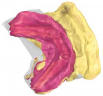 Fig 10. The STL file of the mouth scan body, lower arch.
