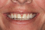 Fig 2. Full smile, close-up view, pretreatment.