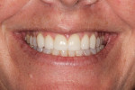 Fig 9. Full smile, close-up view, post-treatment.