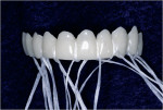 Figure 9  Floss tied around the connectorsaids in clean-up.