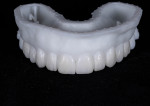 Fig 4. Completed diagnostic wax-up on printed model.