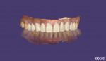 Fig 4. Showing the patient the digital mockup of their smile.