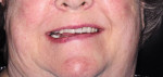 An asymmetric lower lip requires the horizontal plane to be referenced against the pupils of the eyes for correction.