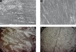 Figure 3  SEM (A and B) and light microscopy photographs (C and D) of representative in vitro treated enamel areas after carbide bur removal of resin attachments (A and C) and carbide bur plus Stainbuster treatment (B and D), respectively.