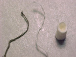 Figure 3  Tissue management can be accomplished with (pictured left to right) braided retraction cord, twisted retraction cord, or a retraction cap.