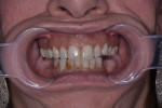 Fig 8. A preoperative intraoral view.