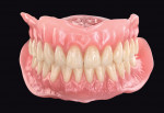 VITA VIONIC VIGO denture teeth