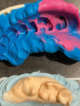 The polyvinyl siloxane impression was treated with a separating agent (GI-Mask® Universal Separator, Coltene) to create a silicon working model and base (Mach-2® Die Silicone, Parkell; Blu-Mousse®, Parkell) for a semi-direct composite restoration protocol.