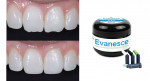 Truly universal for both anterior and posterior composite restorations, Evanesce features ideal, slump-free handling and beautiful shade matching to the VITA shade guide.