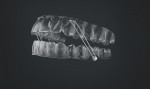 The ClearCorrect aligner system is a comprehensive clear aligner treatment solution that is available to general dentists.
