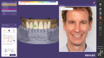 DentalCAD is a powerful software platform with a broad range of design indications, an intuitive user interface, extensive functions, and open tooth and material libraries that guarantee outstanding results.
