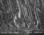 Figure 6a  C-treated dentin cross sections. Untreated dentin; tubules are open.