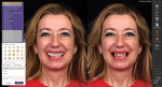 Smile design applications allow patients to view their pretreatment photographs alongside two-dimensional facial visualizations of their potential restorative treatment outcomes.