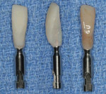 Left to right views of the immediate provisional restoration on the implant analog following contouring, polishing, and staining and glazing.