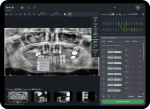 The Denti.AI auto-charting solution recently received FDA-clearance for clinical use.
