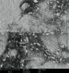 Fig 5. Massive carbonaceous impurity on a titanium implant (SEM 2500x).