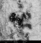 Fig 7. Organic particles (polysiloxanes) on the surface of a titanium implant immediately following removal from the manufacturer’s packaging (SEM 2500x).