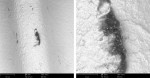 Fig 8 and Fig 9. Organic particle (140 µm) on the surface of a zirconia implant after removal from the manufacturer’s packaging (Fig 8, left, SEM 500x; Fig 9, right, SEM 2500x).
