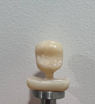 Fig 10. Lithium-disilicate restoration post-milling with right side polished.