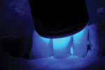 Figure 6  Correct orientation and proximity of the light tip to photopolymerize incisal edge restorations for the mandibular incisors.